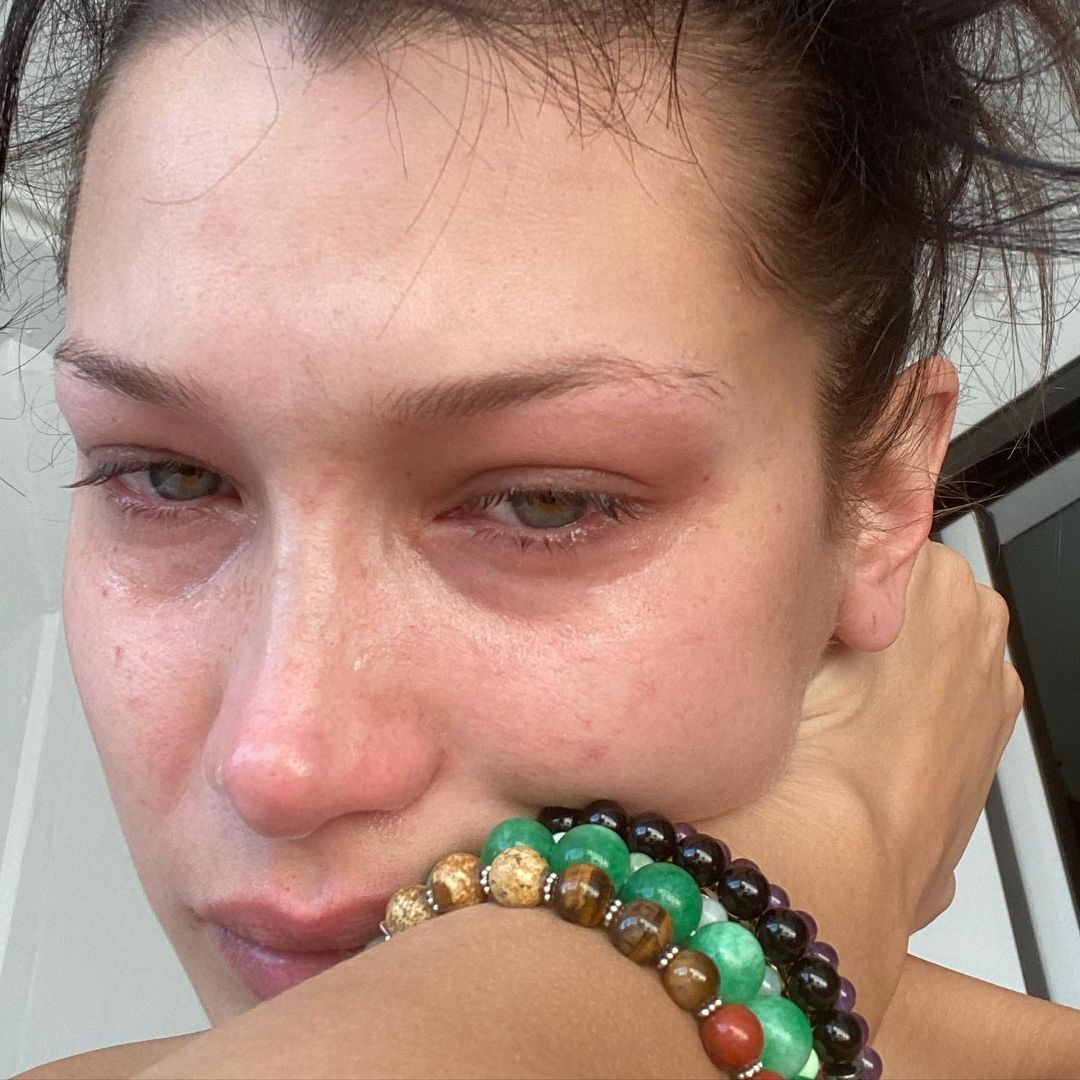Bella Hadid 公開飽受焦慮和抑鬱困擾數年：「社交媒體不是真實的。」，呼籲大眾關注並正視心理健康問題
